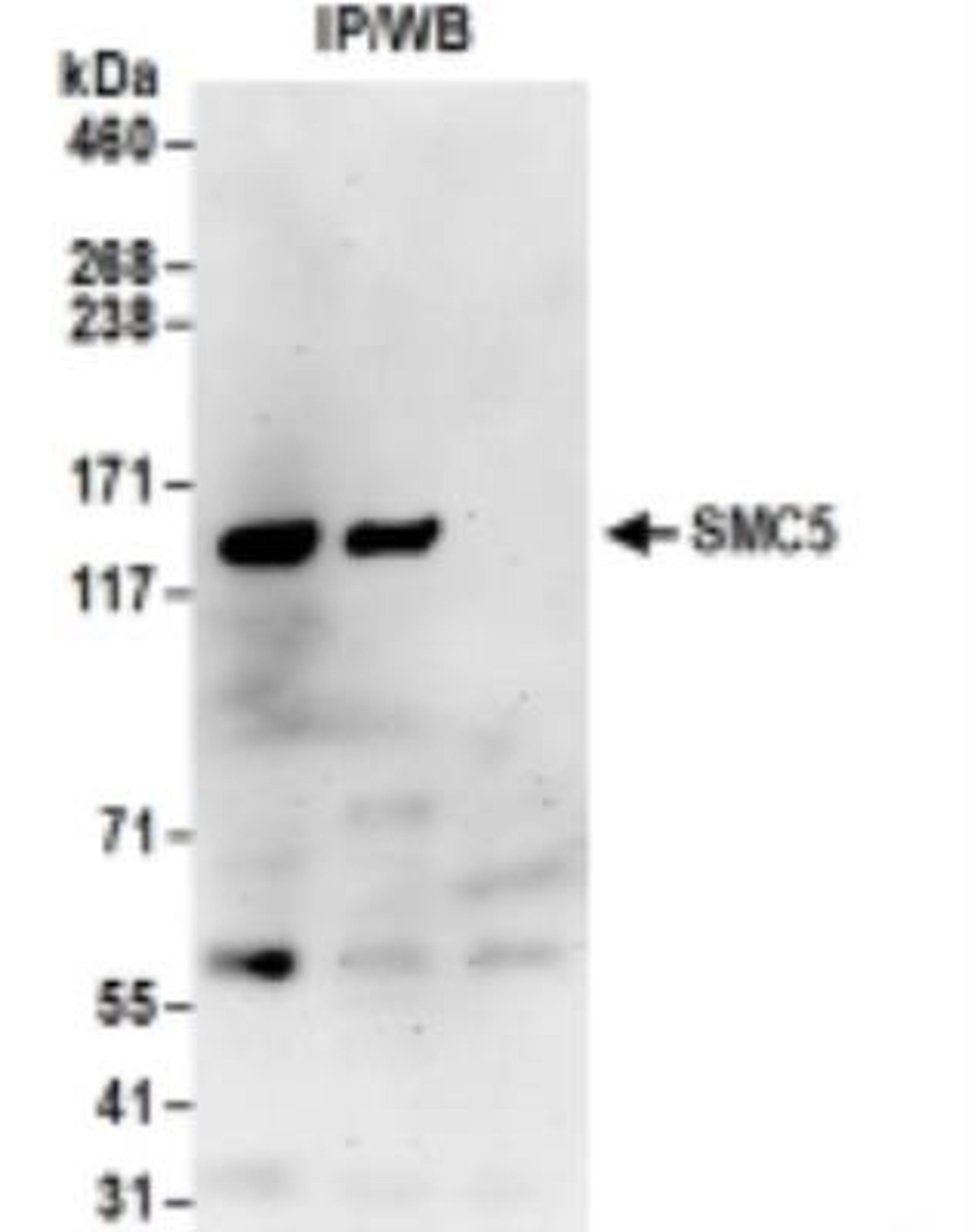 Immunoprecipitation: SMC5 Antibody [NB100-469] - 293T whole cell lysate.