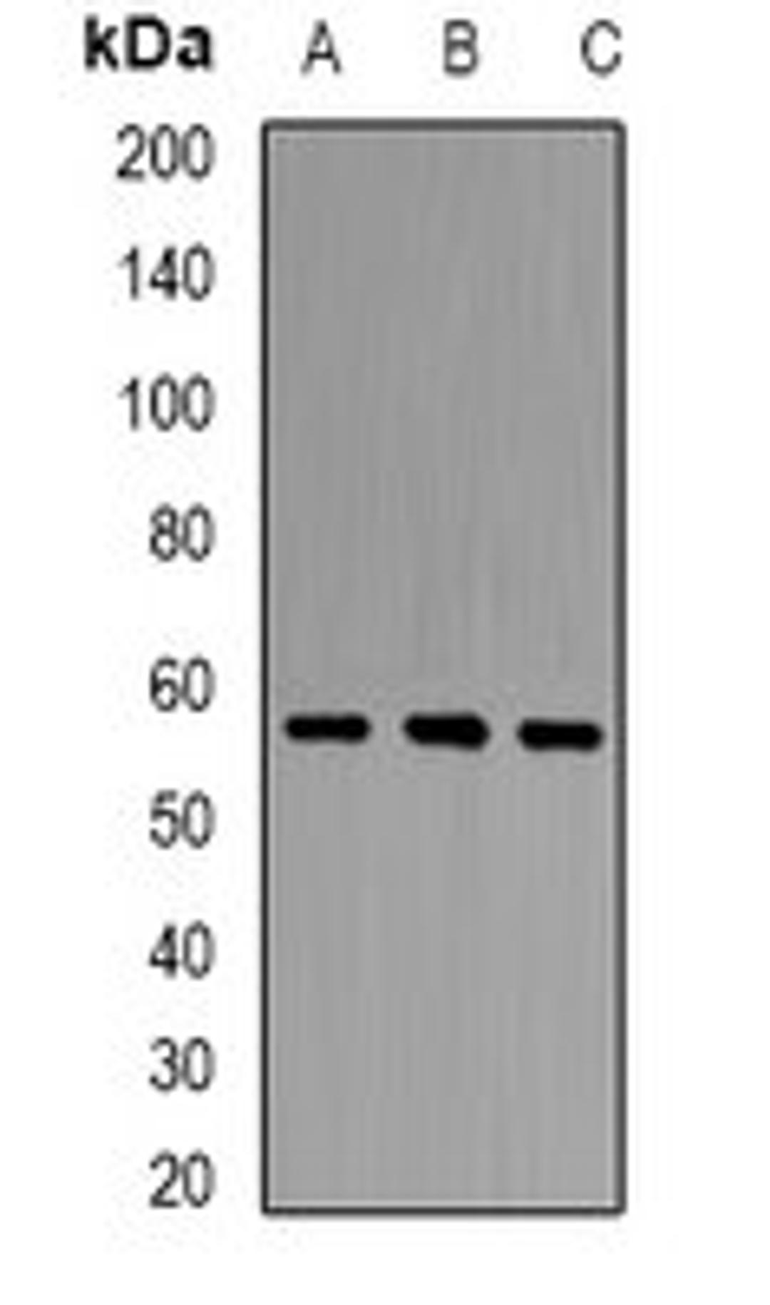 Western blot analysis of HT29 (Lane1), mouse liver (Lane2), mouse heart (Lane3) whole cell lysates using PCCB antibody