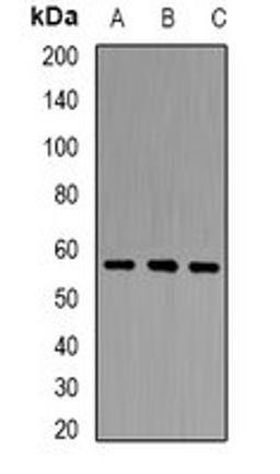 Western blot analysis of HT29 (Lane1), mouse liver (Lane2), mouse heart (Lane3) whole cell lysates using PCCB antibody