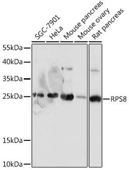 Western blot - RPS8 antibody (A18377)