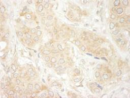 Detection of human DDX19 by immunohistochemistry.