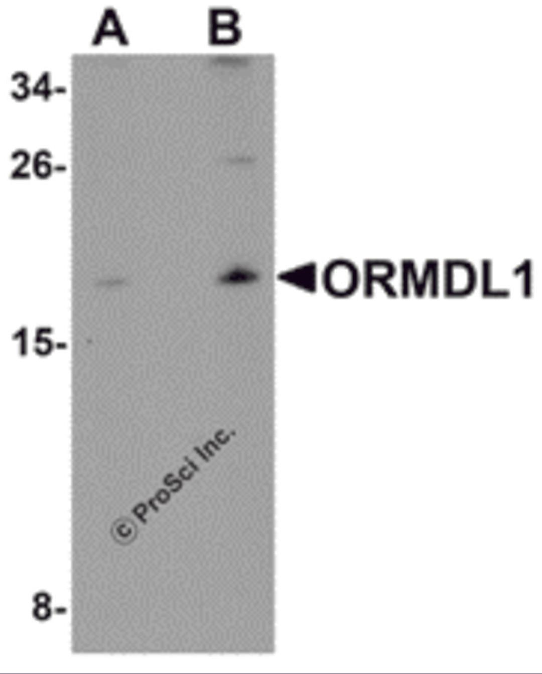 Western blot analysis of ORMDL1 in SK-N-SH Cell lysate with ORMDL1 antibody at (A) 1 μg/mL and (B) 2 μg/mL.