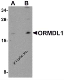 Western blot analysis of ORMDL1 in SK-N-SH Cell lysate with ORMDL1 antibody at (A) 1 μg/mL and (B) 2 μg/mL.
