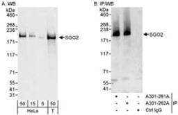 Detection of human SGO2 by western blot and immunoprecipitation.