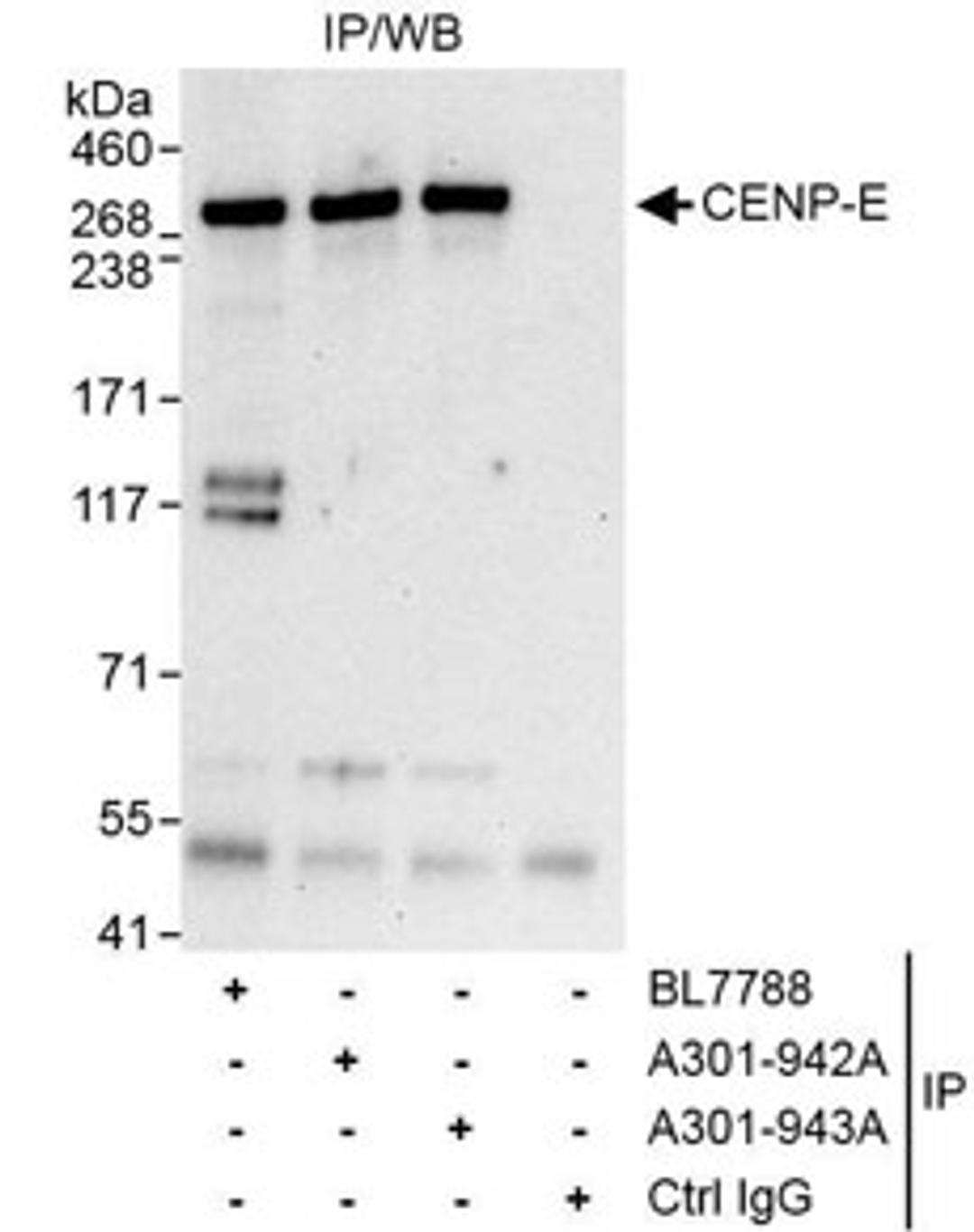 Detection of human CENP-E by western blot of immunoprecipitates.