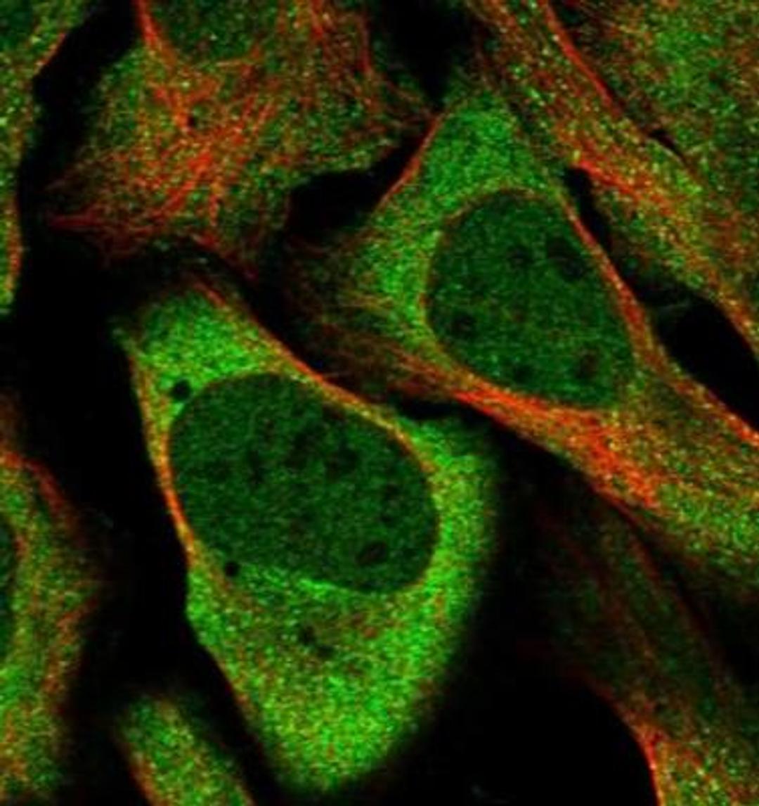 Immunocytochemistry/Immunofluorescence: DNAJC6 Antibody [NBP1-81507] - Staining of human cell line U-2 OS shows positivity in cytoplasm & nucleus but excluded from the nucleoli. Antibody staining is shown in green.