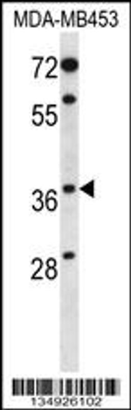 Western blot analysis in MDA-MB453 cell line lysates (35ug/lane).