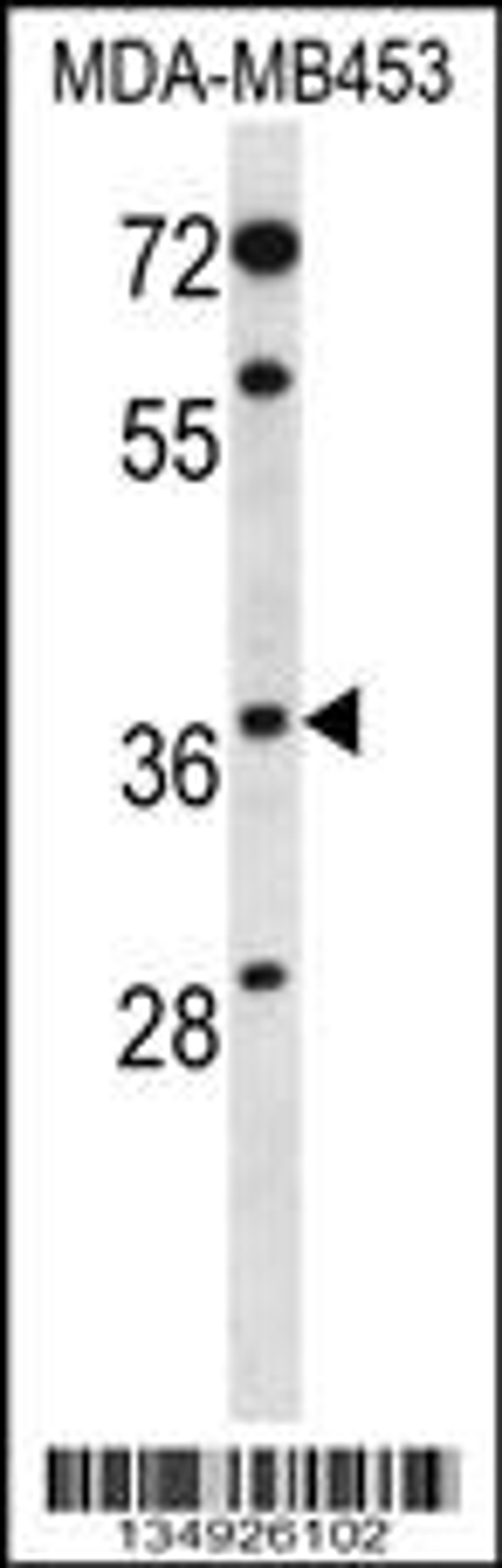 Western blot analysis in MDA-MB453 cell line lysates (35ug/lane).