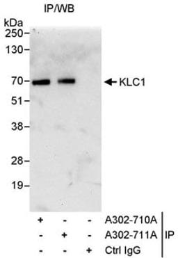 Detection of human KLC1 by western blot of immunoprecipitates.