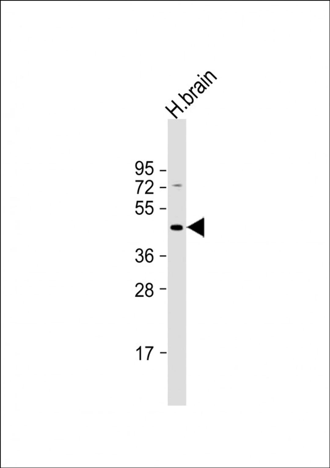 Western Blot at 1:1000 dilution + human brain lysate Lysates/proteins at 20 ug per lane.