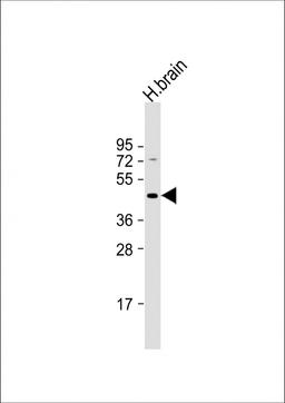 Western Blot at 1:1000 dilution + human brain lysate Lysates/proteins at 20 ug per lane.