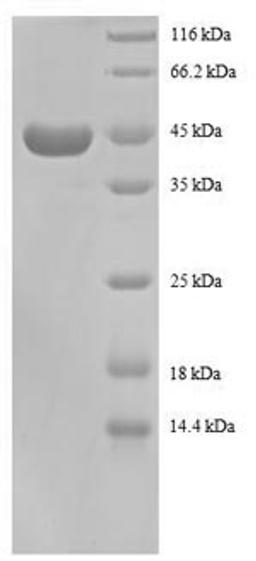 (Tris-Glycine gel) Discontinuous SDS-PAGE (reduced) with 5% enrichment gel and 15% separation gel.