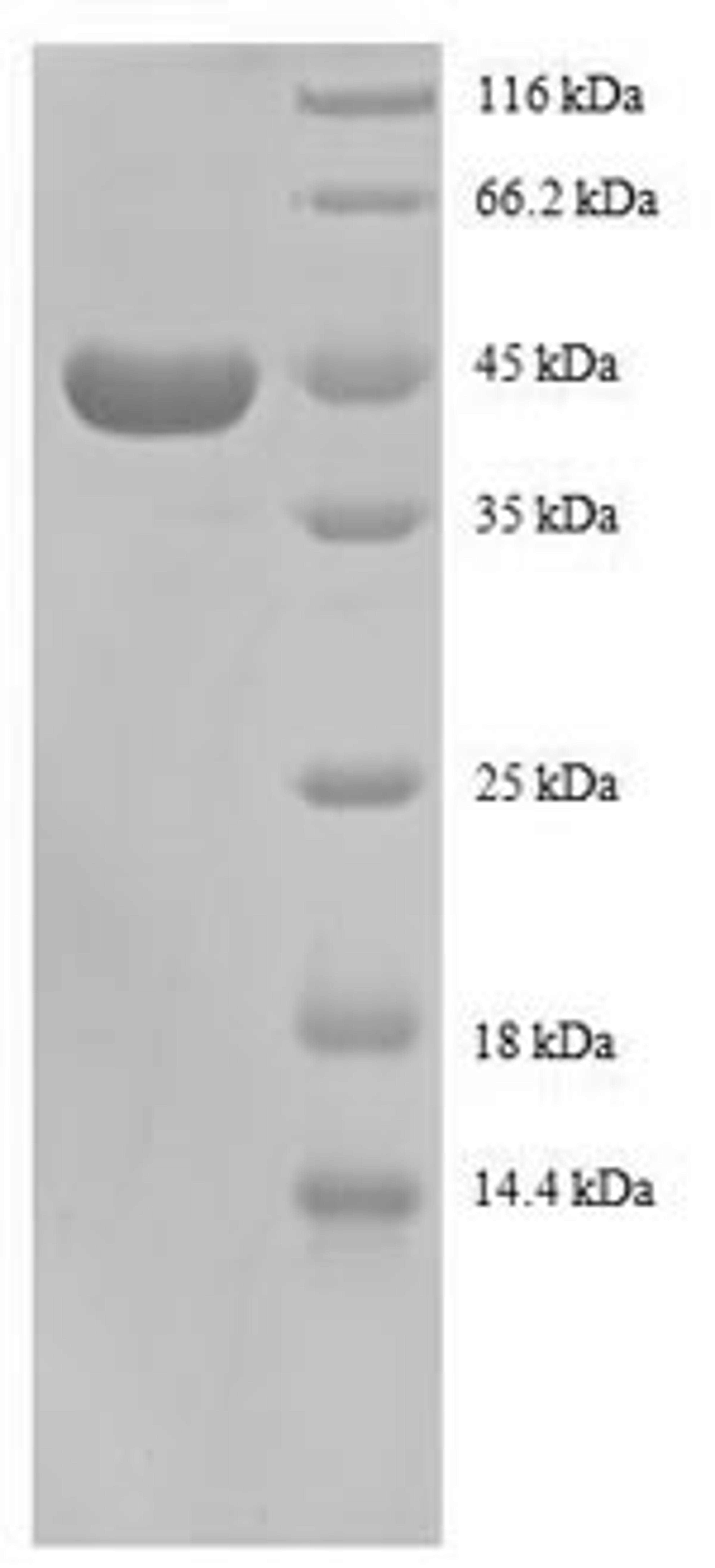 (Tris-Glycine gel) Discontinuous SDS-PAGE (reduced) with 5% enrichment gel and 15% separation gel.
