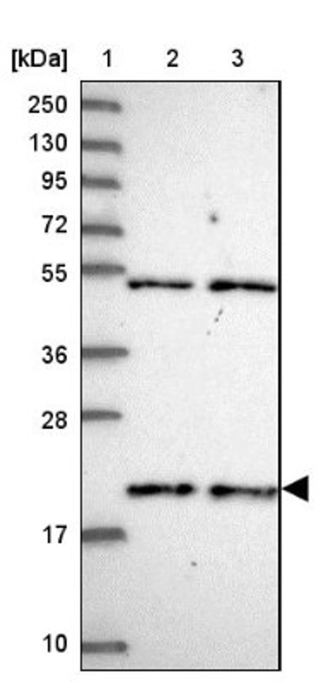 Western Blot: KIAA1143 Antibody [NBP1-92051] - Lane 1: Marker [kDa] 250, 130, 95, 72, 55, 36, 28, 17, 10<br/>Lane 2: Human cell line RT-4<br/>Lane 3: Human cell line U-251MG sp