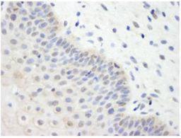 Immunohistochemistry-Paraffin: Ube2L3 Antibody [NB100-2265] - FFPE section of human cervix. A used at a dilution of 1:500.