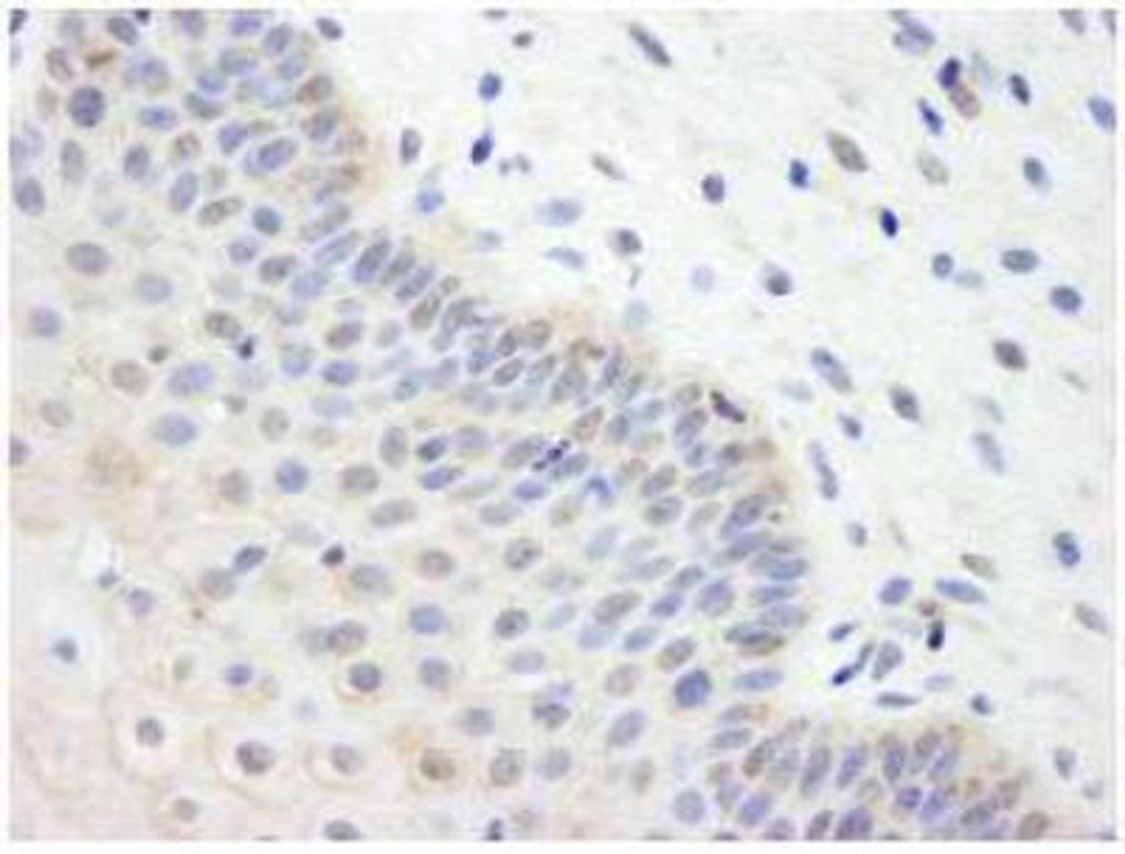 Immunohistochemistry-Paraffin: Ube2L3 Antibody [NB100-2265] - FFPE section of human cervix. A used at a dilution of 1:500.