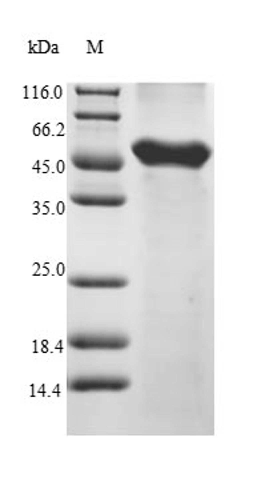 (Tris-Glycine gel) Discontinuous SDS-PAGE (reduced) with 5% enrichment gel and 15% separation gel.