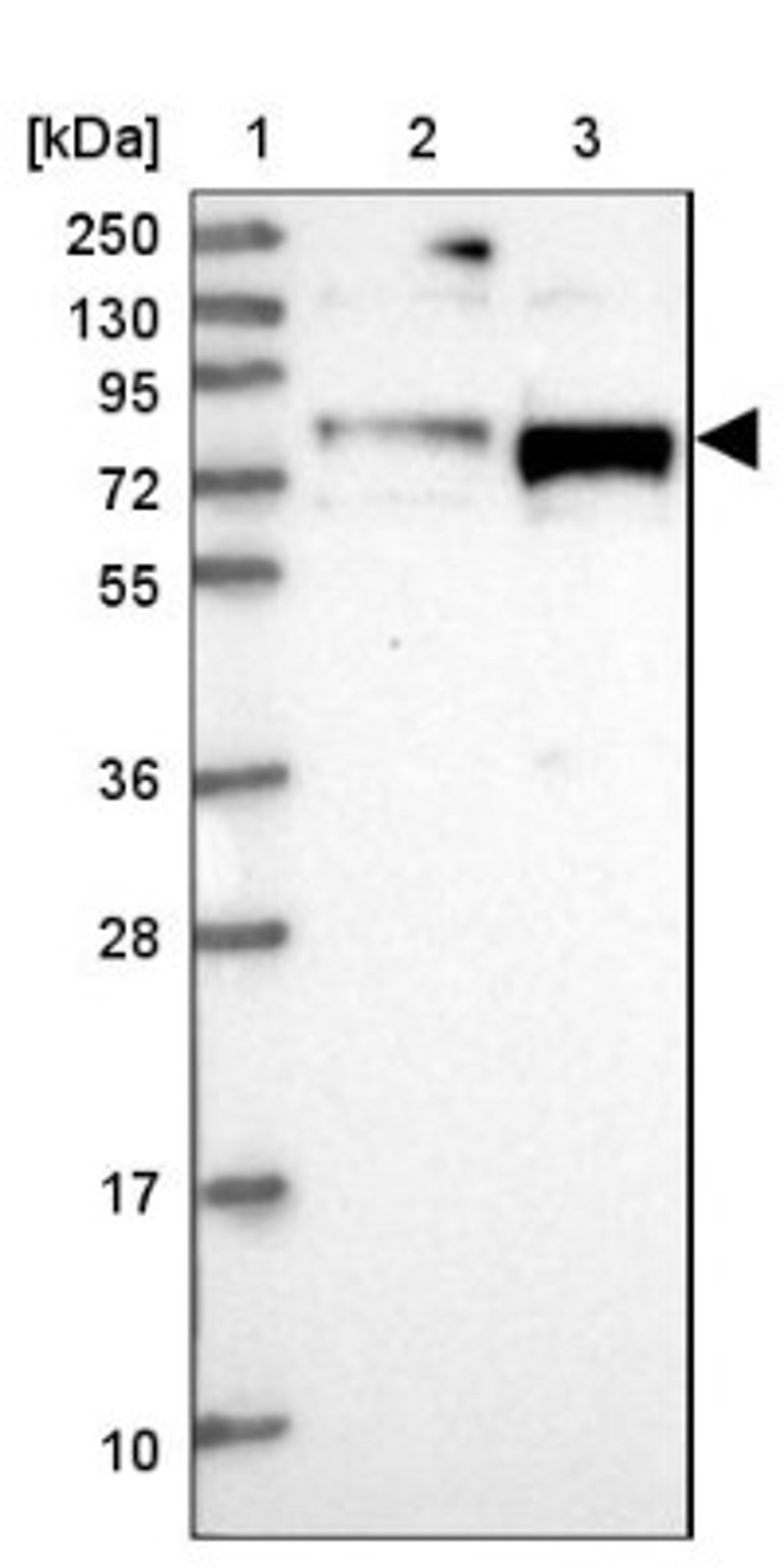 Western Blot: NOL8 Antibody [NBP1-92194] - Lane 1: Marker [kDa] 250, 130, 95, 72, 55, 36, 28, 17, 10<br/>Lane 2: Human cell line RT-4<br/>Lane 3: Human cell line U-251MG sp