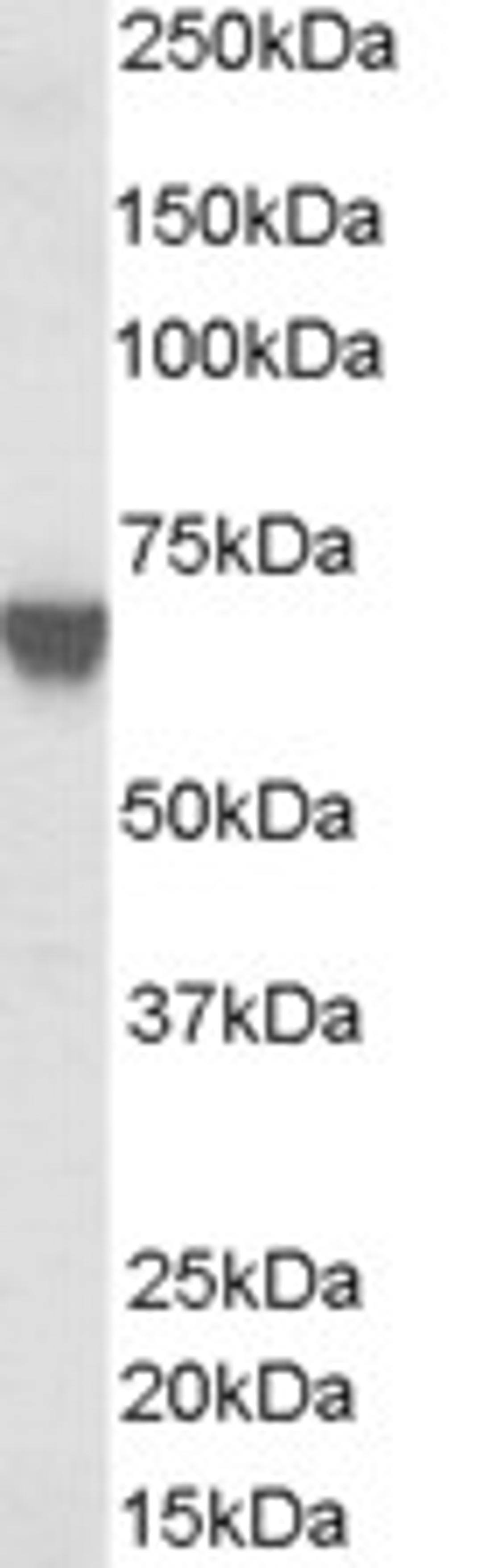 46-505 (0.03ug/ml) staining of A431 lysate (35ug protein in RIPA buffer). Primary incubation was 1 hour. Detected by chemiluminescence.