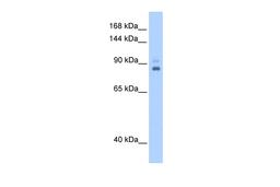 Antibody used in WB on Human 721_B at 0.2-1 ug/ml.