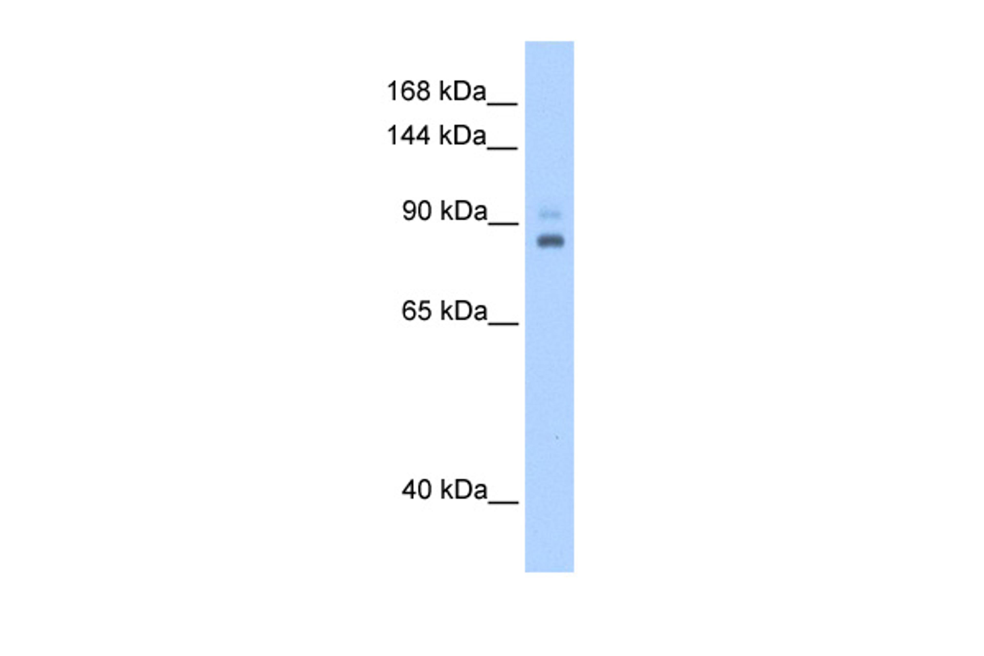 Antibody used in WB on Human 721_B at 0.2-1 ug/ml.