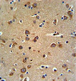 Immunohistrochemical analysis of formalin fixed and paraffin embedded brain tissue using GABRG3 antibody