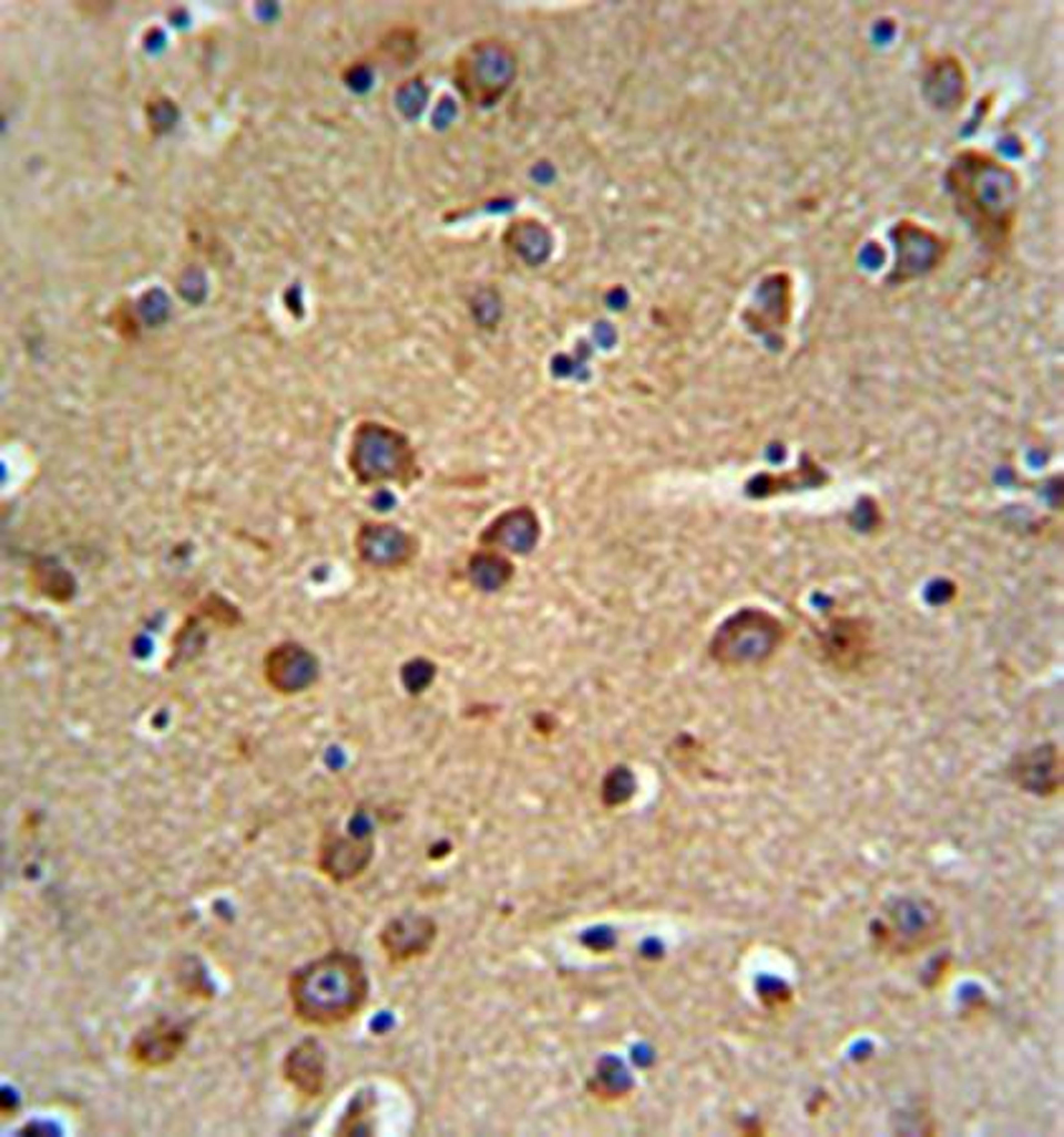 Immunohistrochemical analysis of formalin fixed and paraffin embedded brain tissue using GABRG3 antibody