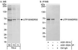 Detection of human UTP18/WDR50 by western blot and immunoprecipitation.