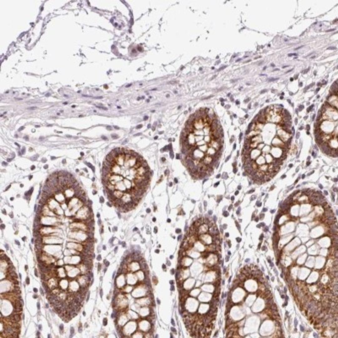 Immunohistochemistry: ABHD11 Antibody [NBP2-33574] - Immunohistochemical staining of human colon shows strong cytoplasmic positivity in glandular cells.