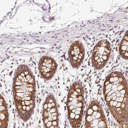 Immunohistochemistry: ABHD11 Antibody [NBP2-33574] - Immunohistochemical staining of human colon shows strong cytoplasmic positivity in glandular cells.