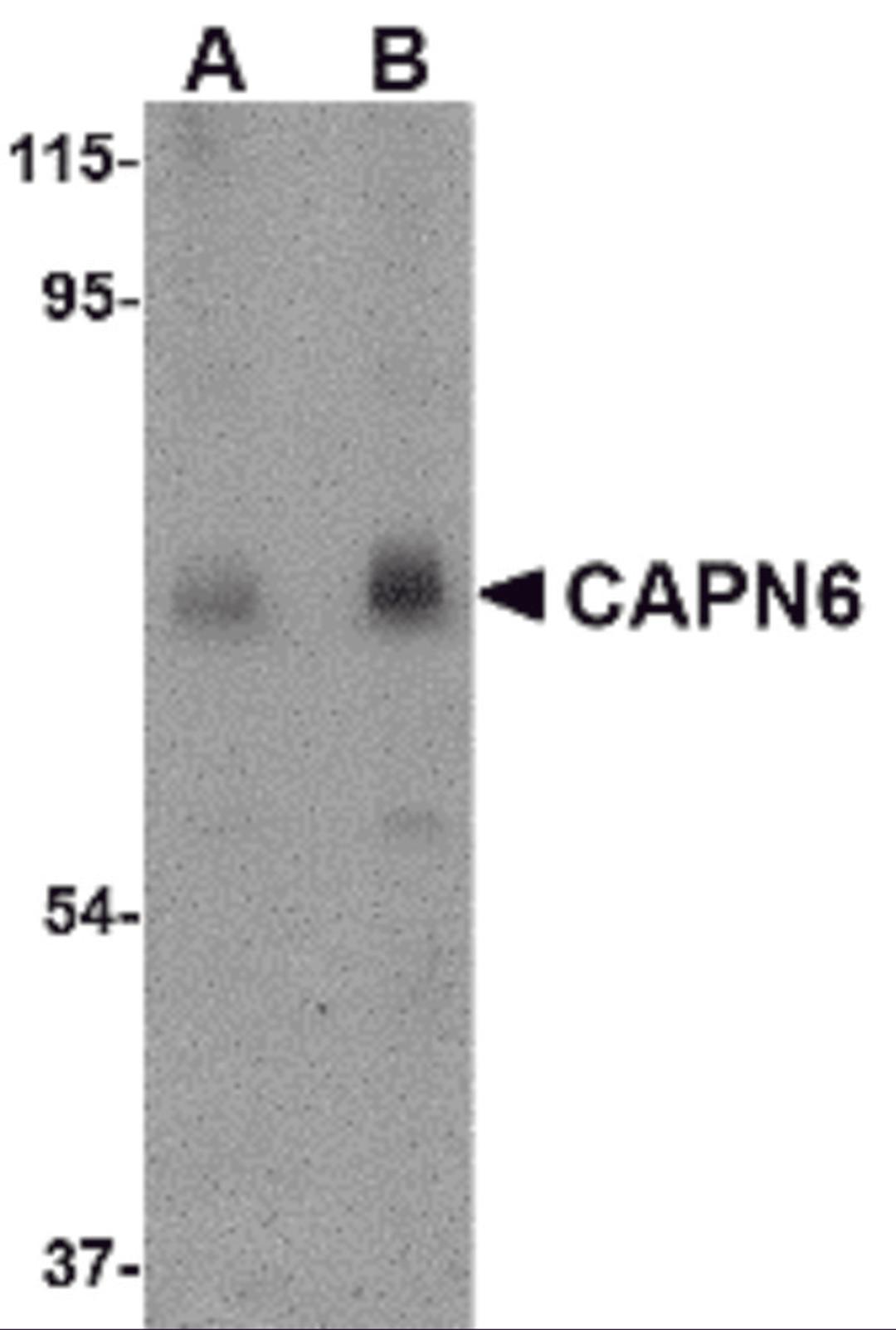Western blot analysis of CAPN6 in rat lung tissue lysate with CAPN6 antibody at (A) 0.5 and (B) 1 μg/mL.