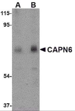 Western blot analysis of CAPN6 in rat lung tissue lysate with CAPN6 antibody at (A) 0.5 and (B) 1 μg/mL.