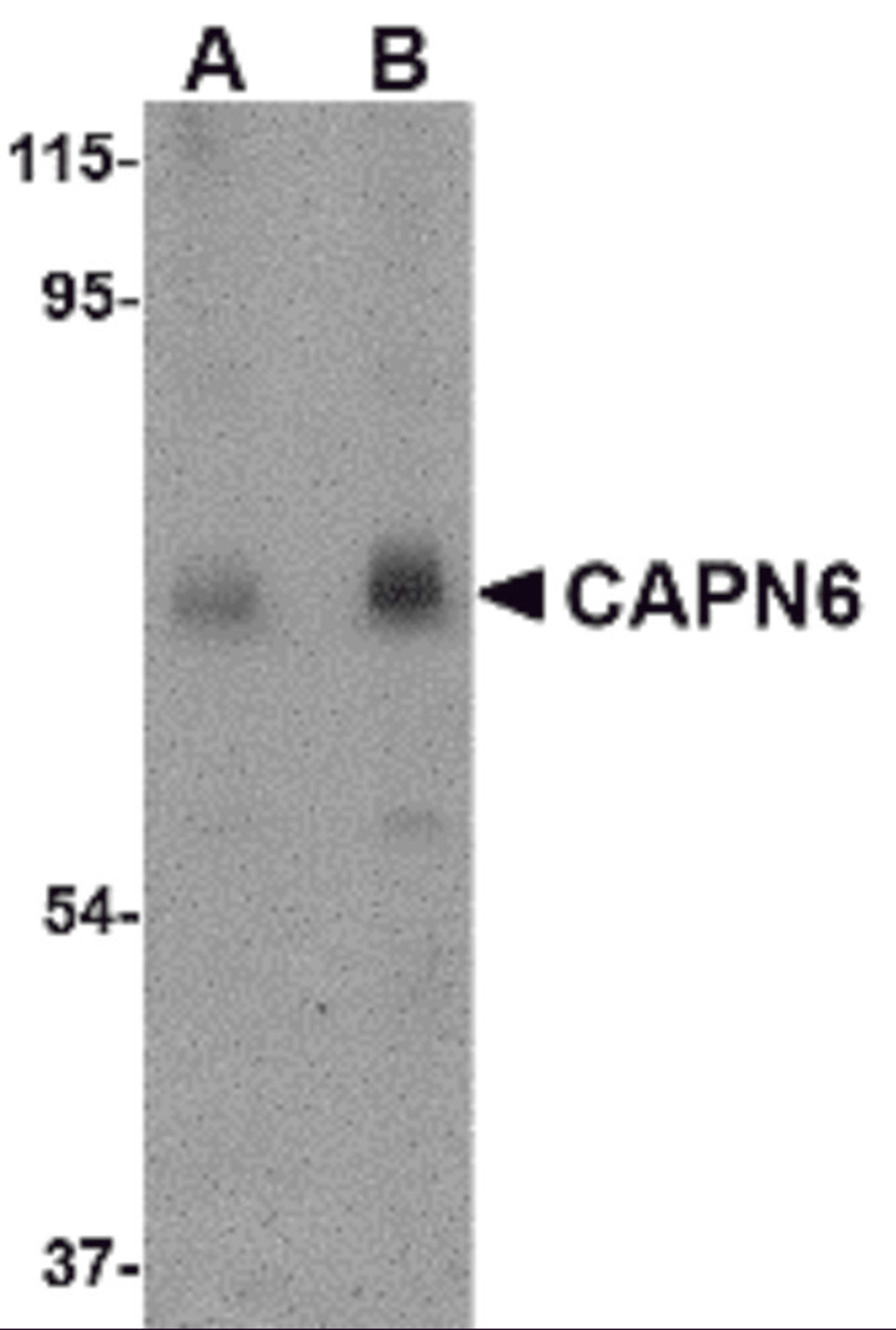 Western blot analysis of CAPN6 in rat lung tissue lysate with CAPN6 antibody at (A) 0.5 and (B) 1 μg/mL.