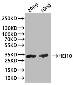 Western Blot. Positive WB detected in: recombinant protein. All lanes:HEI10 Antibody at 1:1000. Secondary. Goat polyclonal to rabbit IgG at 1/20000 dilution. Predicted band size: 27.9 kDa. Observed band size: 31 kDa. 