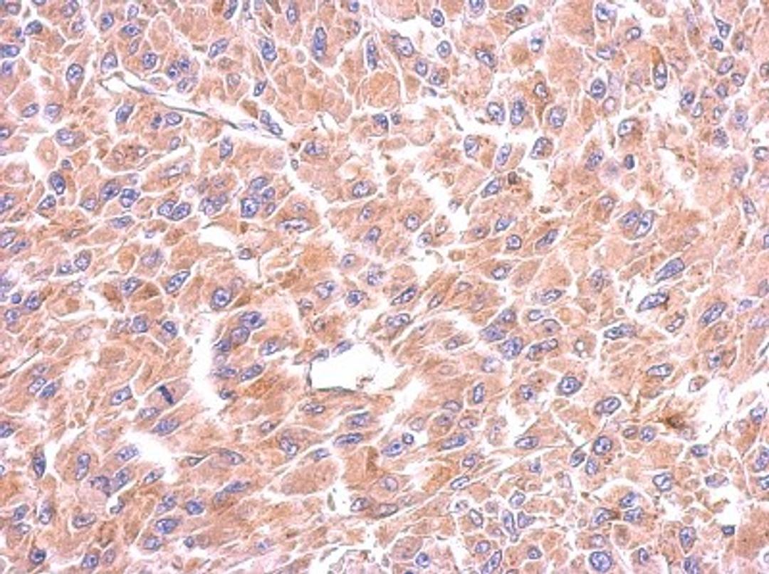 Immunohistochemistry-Paraffin: Tryptophanyl tRNA synthetase Antibody [NBP2-20744] - Immunohistochemical analysis of paraffin-embedded U87 xenograft, using antibody at 1:500 dilution.