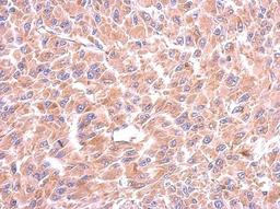 Immunohistochemistry-Paraffin: Tryptophanyl tRNA synthetase Antibody [NBP2-20744] - Immunohistochemical analysis of paraffin-embedded U87 xenograft, using antibody at 1:500 dilution.