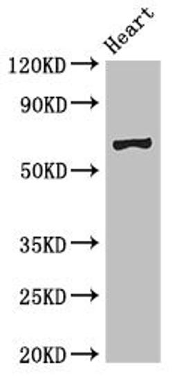 Western Blot. Positive WB detected in: Mouse heart tissue. All lanes: PES1 antibody at 3ug/ml. Secondary. Goat polyclonal to rabbit IgG at 1/50000 dilution. Predicted band size: 69, 68 kDa. Observed band size: 69 kDa. 