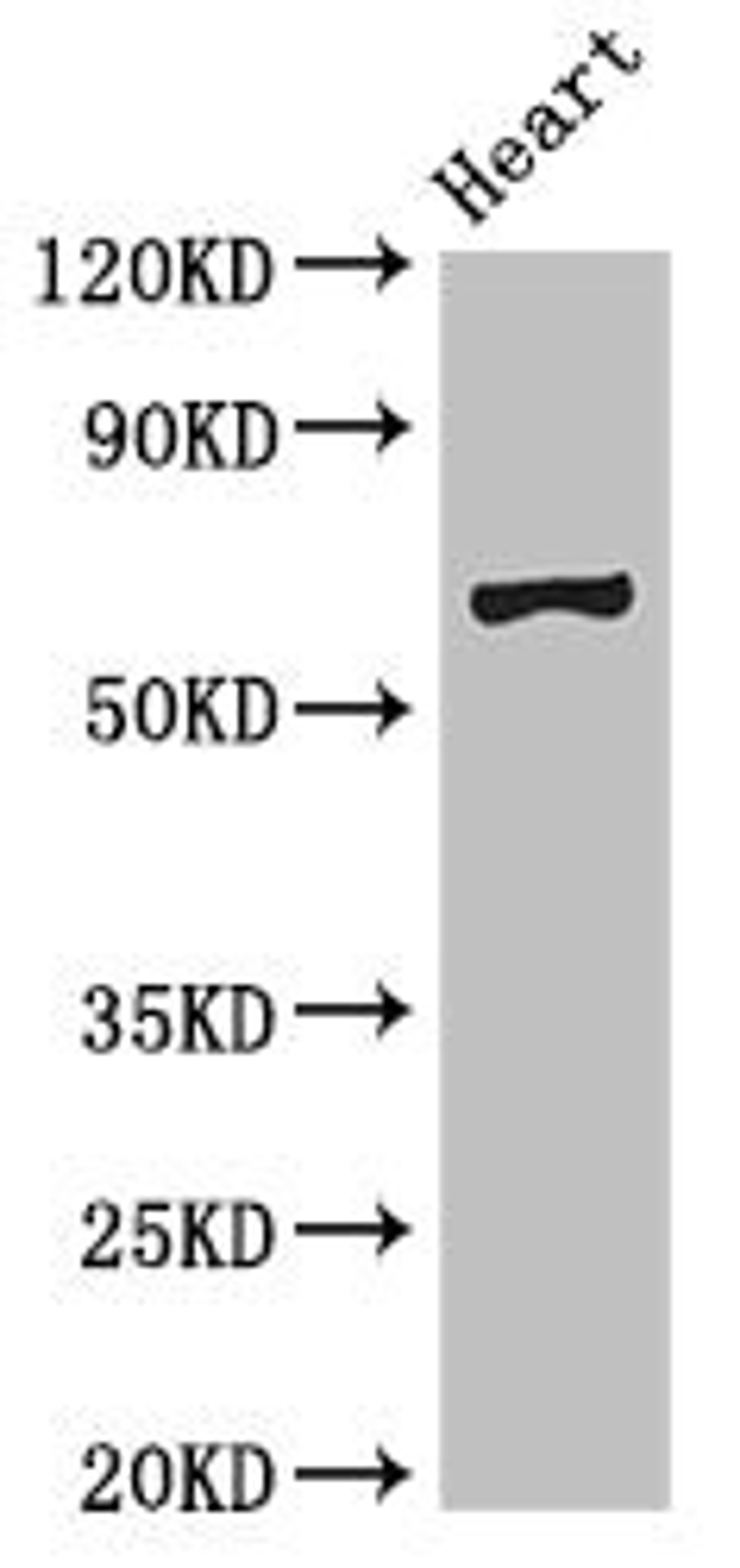 Western Blot. Positive WB detected in: Mouse heart tissue. All lanes: PES1 antibody at 3ug/ml. Secondary. Goat polyclonal to rabbit IgG at 1/50000 dilution. Predicted band size: 69, 68 kDa. Observed band size: 69 kDa. 