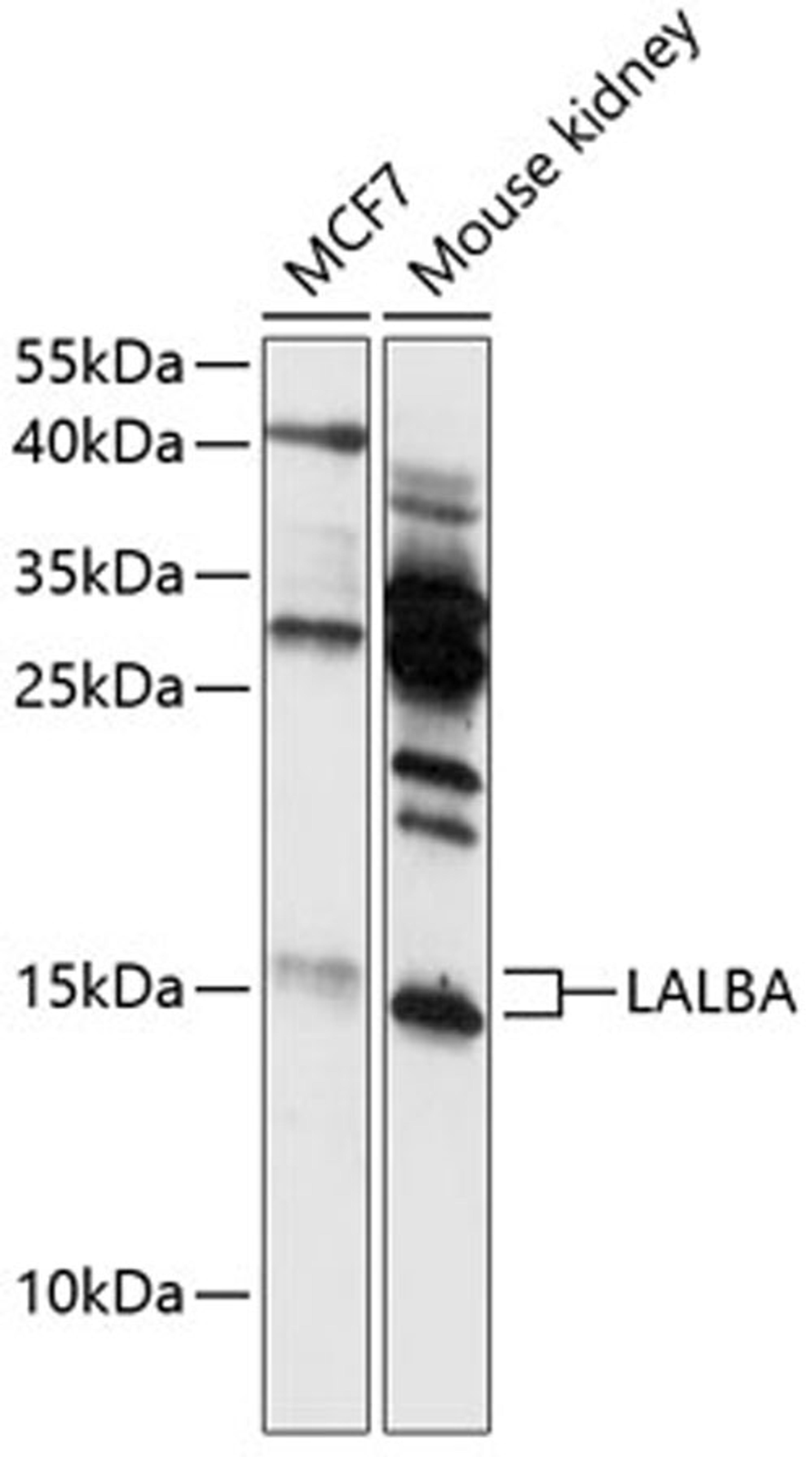 Western blot - LALBA antibody (A12690)