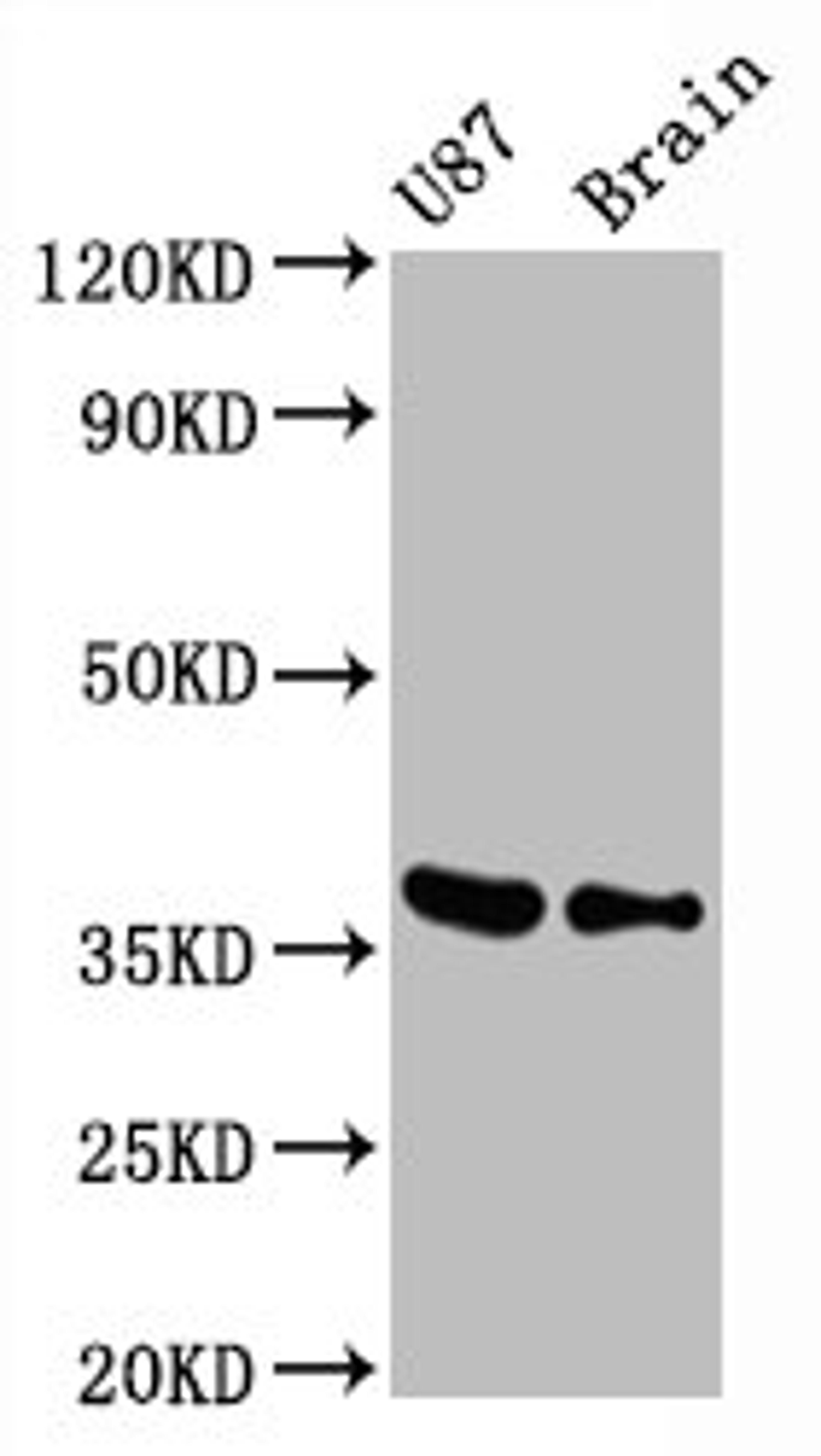 Western BlotPositive WB detected in U87 whole cell lysate, Mouse brain tissueAll lanes GAPDH antibody at 0.31μg/mlSecondaryGoat polyclonal to rabbit IgG at 1/50000 dilutionPredicted band size: 36 KDaObserved band size: 36 KDa