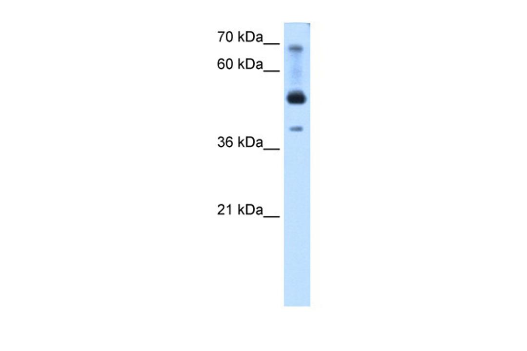 Antibody used in WB on Transfected 293T at 0.2-1 ug/ml.