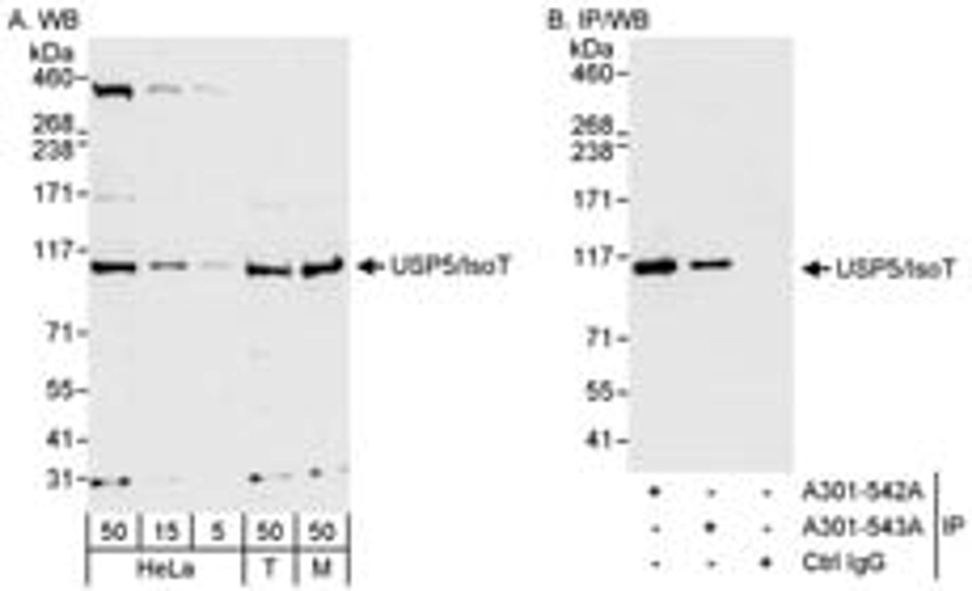 Detection of human and mouse USP5/IsoT by western blot (h&m) and immunoprecipitation (h).