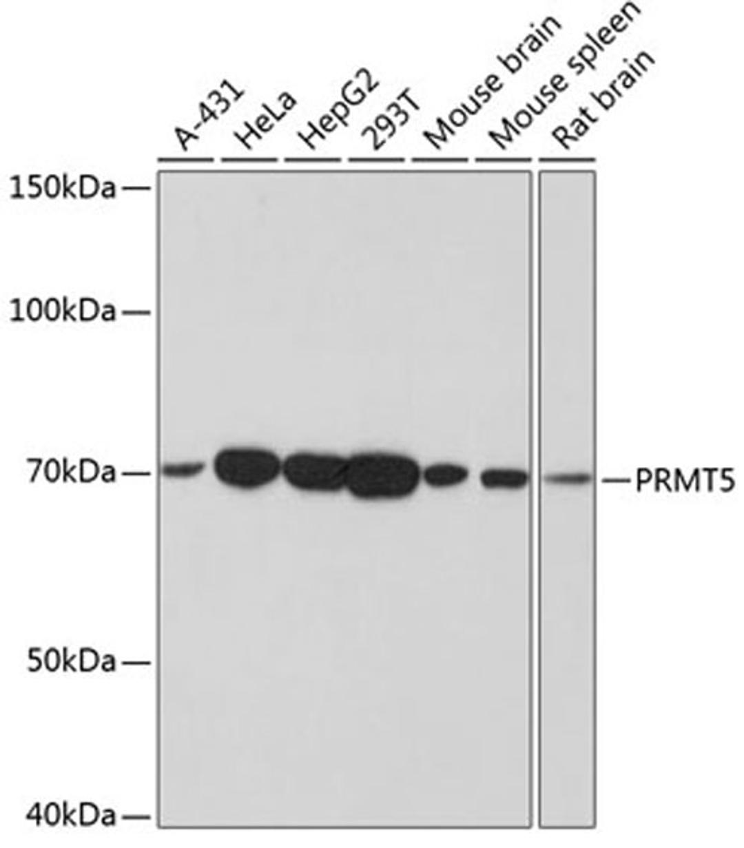 Western blot - PRMT5 antibody (A19533)