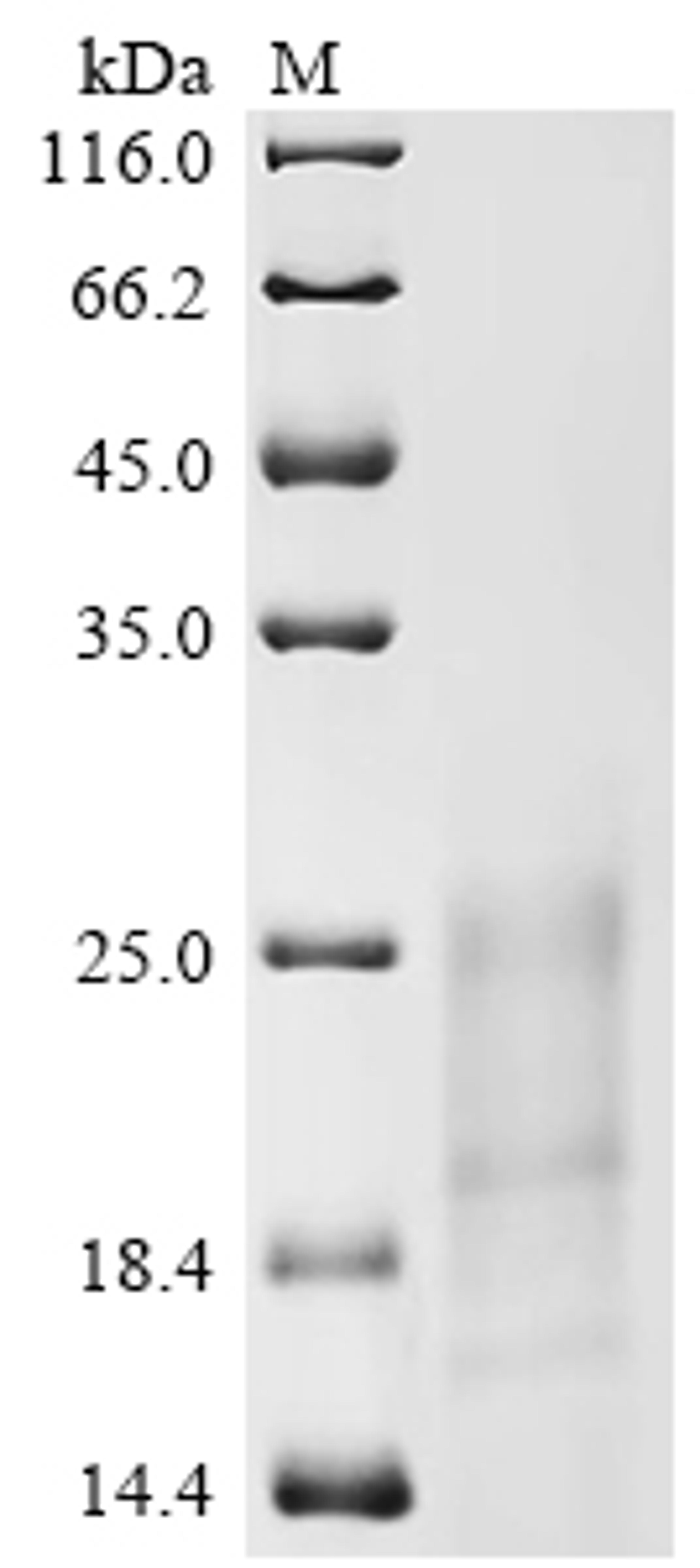 (Tris-Glycine gel) Discontinuous SDS-PAGE (reduced) with 5% enrichment gel and 15% separation gel.