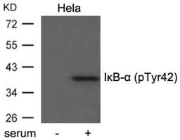 Western blot analysis of extract from HeLa cells untreated or treated with serum using I&#954;B-&#945; (Phospho-Tyr42).