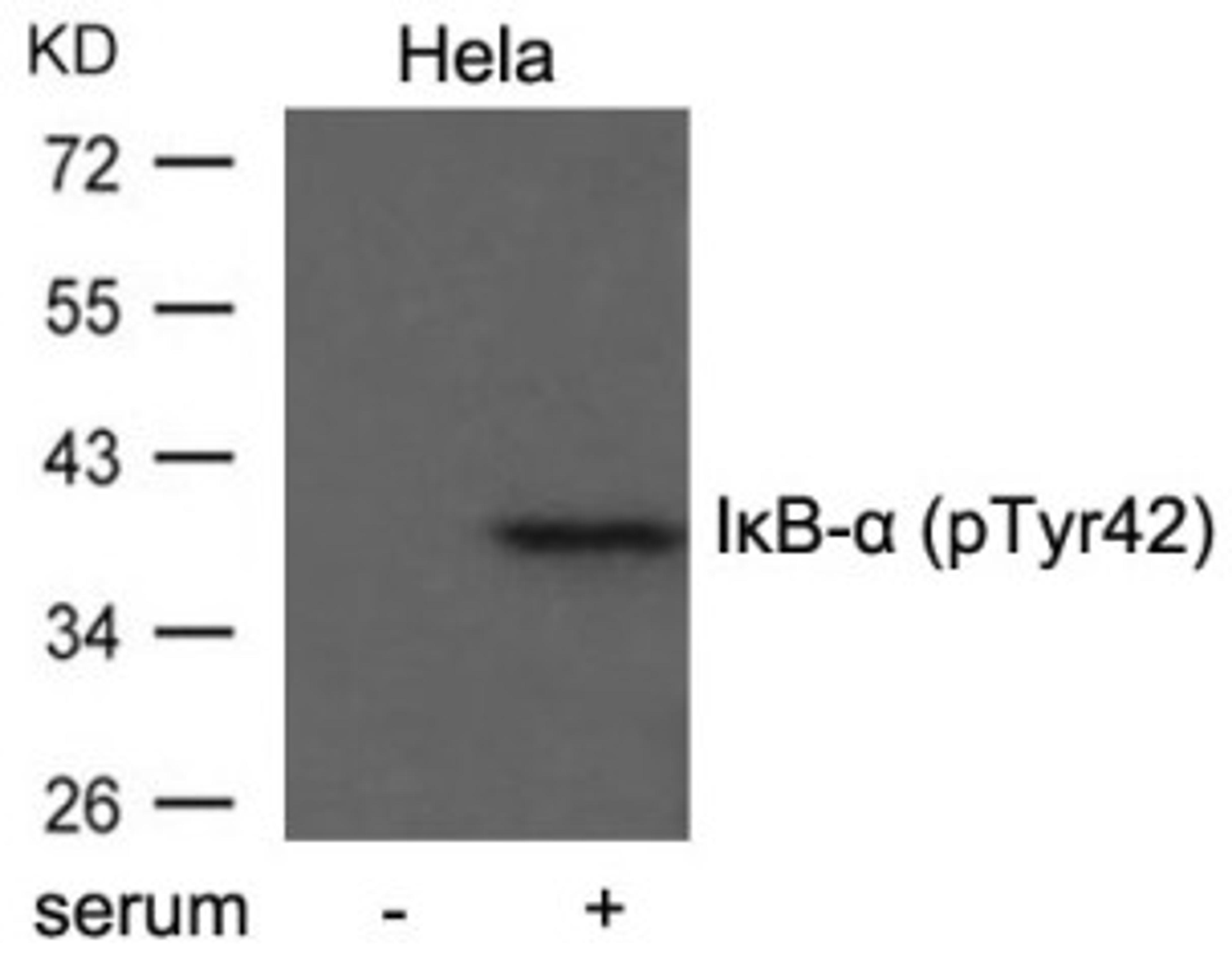 Western blot analysis of extract from HeLa cells untreated or treated with serum using I&#954;B-&#945; (Phospho-Tyr42).