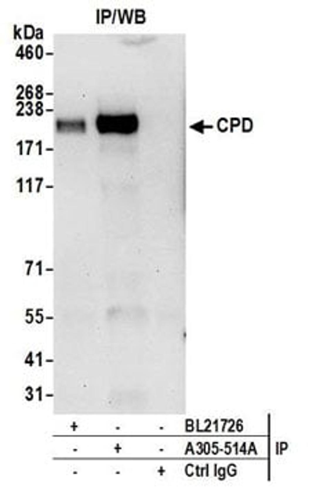 Detection of human CPD by western blot of immunoprecipitates.