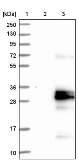 Western Blot: Glycodelin Antibody [NBP1-89781] - Lane 1: Marker [kDa] 250, 130, 95, 72, 55, 36, 28, 17, 10<br/>Lane 2: Negative control (vector only transfected HEK293T lysate)<br/>Lane 3: Over-expression lysate (Co-expressed with a C-terminal myc-DDK tag (~3.1 kDa) in mammalian HEK293T cells, LY419242)