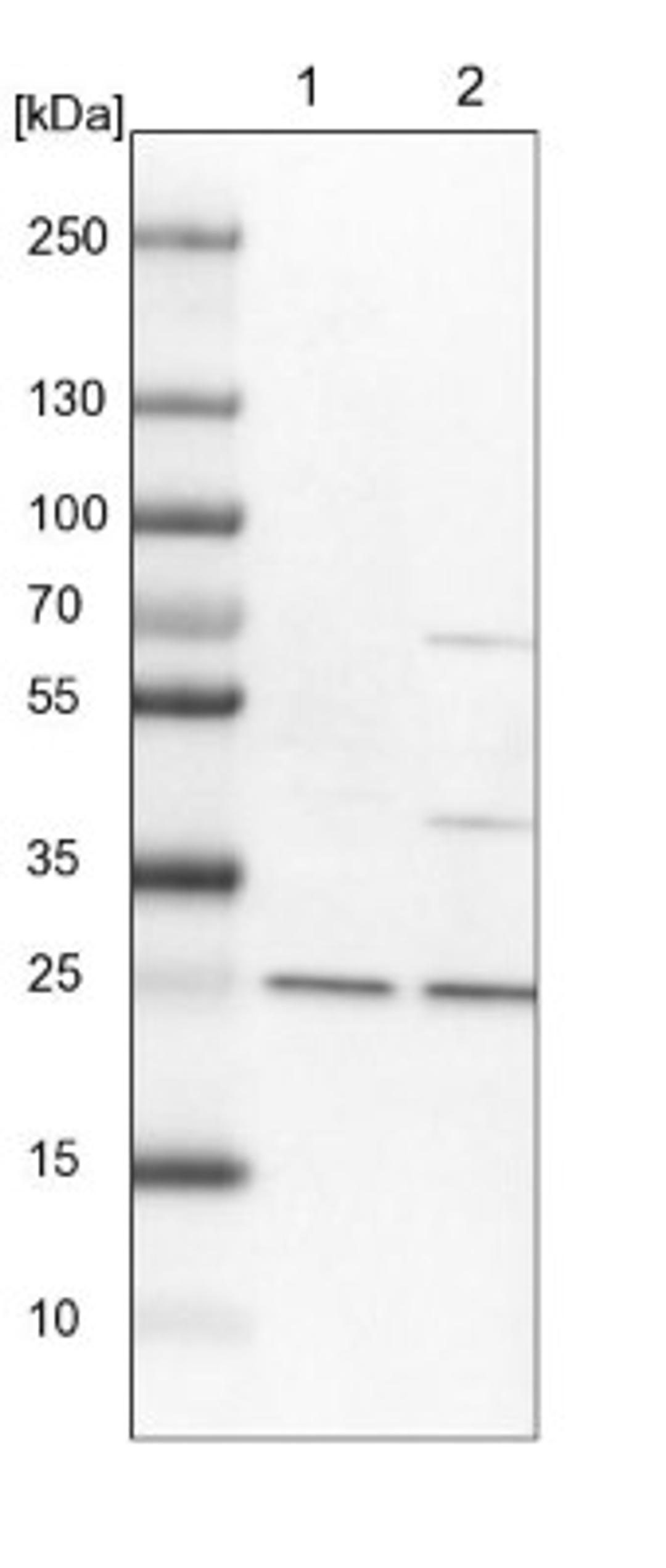 Western Blot: Dynactin 6 Antibody [NBP1-80616] - Lane 1: NIH-3T3 cell lysate (Mouse embryonic fibroblast cells)<br/>Lane 2: NBT-II cell lysate (Rat Wistar bladder tumour cells)