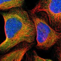 Immunocytochemistry/ Immunofluorescence: ASMTL Antibody [NBP1-86154] - Staining of human cell line U-2 OS shows positivity in cytoplasm.